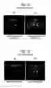 Fig. 16 - Making different corrections for different areas of magnetic resonance image data