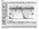 Fig. 07 - BIDIRECTIONAL OPTICAL SUB ASSEMBLY HAVING STRUCTURE TO REDUCE REFLECTION NOISE
