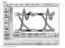 Fig. 08 - BIDIRECTIONAL OPTICAL SUB ASSEMBLY HAVING STRUCTURE TO REDUCE REFLECTION NOISE