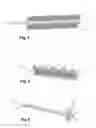 Fig. 04 - Applicator having a twisted core that gives off heat