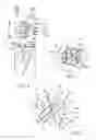 Fig. 04 - Fluted drill and fluted drill cutting head therefor
