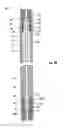 Fig. 09 - Plunger for downhole pumps