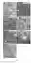 Fig. 05 - Targeting Kidney Mesangium With Nanoparticles of Defined Diameter