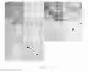 Fig. 07 - Targeting Kidney Mesangium With Nanoparticles of Defined Diameter