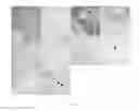 Fig. 07 - Targeting Kidney Mesangium With Nanoparticles of Defined Diameter