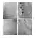 Fig. 09 - Targeting Kidney Mesangium With Nanoparticles of Defined Diameter