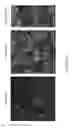 Fig. 11 - Targeting Kidney Mesangium With Nanoparticles of Defined Diameter