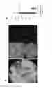 Fig. 12 - Targeting Kidney Mesangium With Nanoparticles of Defined Diameter