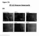 Fig. 78 - Anti-NGF compositions and use thereof