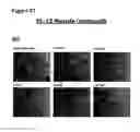 Fig. 79 - Anti-NGF compositions and use thereof