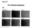 Fig. 89 - Anti-NGF compositions and use thereof