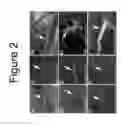 Fig. 03 - Peptides and aptamers for targeting of neuron or nerves