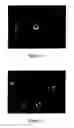 Fig. 03 - Methods and storage and retrieval of functional mature retinal cells
