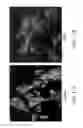 Fig. 19 - Conditioned medium and proliferated cell lines produced therefrom