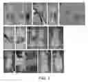 Fig. 02 - COMPOSITIONS AND METHODS TO GENERATE PILOSEBACEOUS UNITS