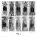Fig. 05 - COMPOSITIONS AND METHODS TO GENERATE PILOSEBACEOUS UNITS