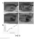 Fig. 06 - COMPOSITIONS AND METHODS TO GENERATE PILOSEBACEOUS UNITS