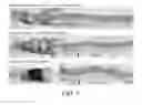Fig. 07 - COMPOSITIONS AND METHODS TO GENERATE PILOSEBACEOUS UNITS