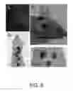 Fig. 08 - COMPOSITIONS AND METHODS TO GENERATE PILOSEBACEOUS UNITS