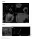 Fig. 02 - SYNTHETIC GRAFT