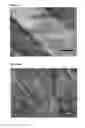 Fig. 03 - SYNTHETIC GRAFT