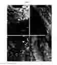 Fig. 06 - SYNTHETIC GRAFT