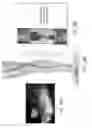 Fig. 13 - PERICYTE PROGENITOR CELLS AND METHODS OF GENERATING AND USING SAME