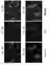 Fig. 20 - PERICYTE PROGENITOR CELLS AND METHODS OF GENERATING AND USING SAME
