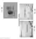 Fig. 23 - PERICYTE PROGENITOR CELLS AND METHODS OF GENERATING AND USING SAME