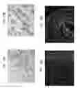 Fig. 24 - PERICYTE PROGENITOR CELLS AND METHODS OF GENERATING AND USING SAME