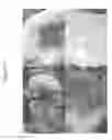 Fig. 04 - Joint Repair Using Mesenchymal Stem Cells