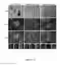Fig. 08 - Method to isolate, identify, and use embryonic stem cells directed to forebrain interneuron fate