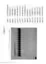 Fig. 09 - Formulations for lysosomal enzymes