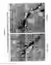 Fig. 06 - Delivery of therapeutic compounds to the brain and other tissues