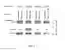 Fig. 02 - PRODUCT AND METHOD FOR TREATMENT OF CONDITIONS ASSOCIATED WITH RECEPTOR-DESENSITIZATION