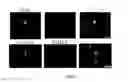 Fig. 06 - Antibodies that bind amyloid oligomers
