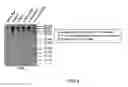 Fig. 07 - Antibodies that bind amyloid oligomers