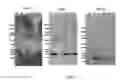 Fig. 08 - Antibodies that bind amyloid oligomers