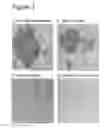 Fig. 04 - Interaction of with epithelial cells, extracellular matrix proteins and the complement system