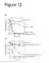 Fig. 13 - Interaction of with epithelial cells, extracellular matrix proteins and the complement system