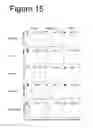 Fig. 16 - Interaction of with epithelial cells, extracellular matrix proteins and the complement system