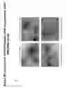 Fig. 33 - PEGYLATED POLYPLEXES FOR POLYNUCLEOTIDE DELIVERY