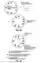 Fig. 05 - Intracoronary device and method of use thereof