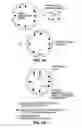 Fig. 06 - Intracoronary device and method of use thereof