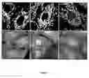 Fig. 02 - Peptides that down regulate the activity of plasma membrane transporters including sodium-D-glucose cotransporter SGLT1