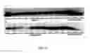Fig. 05 - CONTROLLED RELEASE PARTICLES CONTAINING ACID FIBROBLAST GROWTH FACTOR