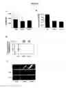 Fig. 04 - PREVENTION OF THROMBUS FORMATION AND/OR STABILIZATION