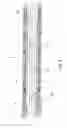 Fig. 07 - REINFORCEMENT COMPRISING PARALLEL ROVINGS OF GLASS STRANDS