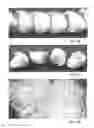 Fig. 08 - LONG-FIBER-REINFORCED POLYMER MATERIAL AND METHOD AND INSTALLATION FOR ITS MANUFACTURE