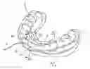 Fig. 01 - ORTHODONTIC APPLIANCE